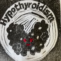 Hypothyroidism Patch