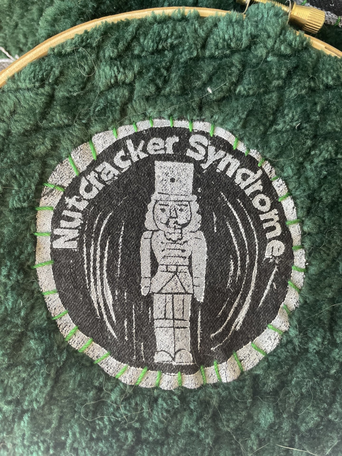 Nutcracker Syndrome Patch
