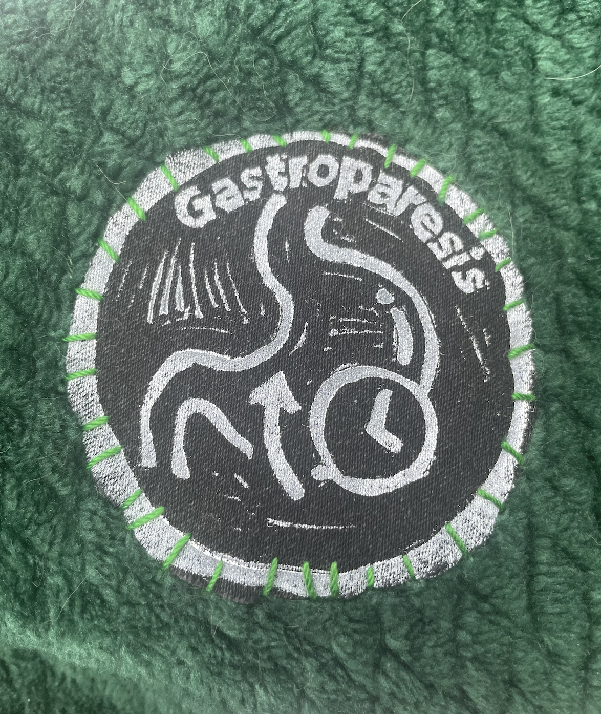 Gastroparesis Patch