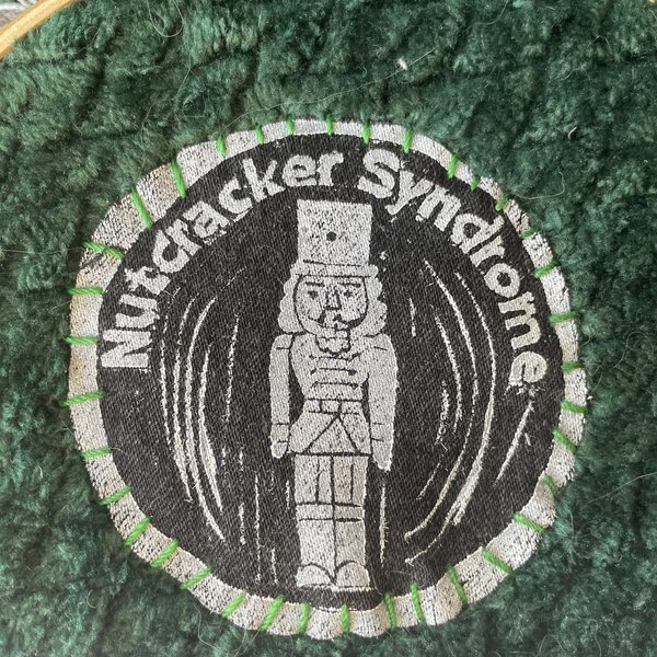 Nutcracker Syndrome Patch